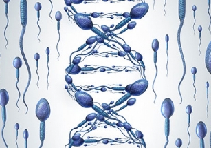 Sperm DNA Hasar Tespiti